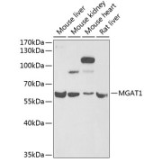 Western blot analysis of various lysates using MGAT1 Antibody at 1/1000 dilution. Secondary antibody: HRP-conjugated Goat anti-Rabbit IgG (H+L) at 1/10000 dilution. Lysates/proteins: 25 µg per lane. Blocking buffer: 3% nonfat dry milk in TBST. Exposure time: 90s.