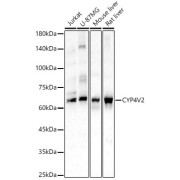 Western blot analysis of various lysates, using CYP4V2 Antibody at 1/900 dilution. Secondary antibody: HRP-conjugated Goat anti-Rabbit IgG (H+L) at 1/10000 dilution. Lysates/proteins: 25 µg per lane. Blocking buffer: 3% nonfat dry milk in TBST. Exposure time: 30s.