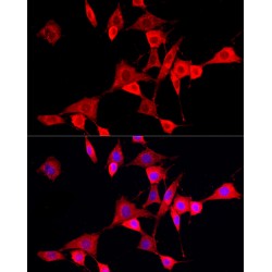 Cytochrome P450 Family 4 Subfamily V Member 2 (CYP4V2) Antibody