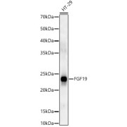 Western blot analysis of lysates from HT-29 cells, using FGF19 Antibody at 1/500 dilution. Secondary antibody: HRP-conjugated Goat anti-Rabbit IgG (H+L) at 1/10000 dilution. Lysates/proteins: 25 µg per lane. Blocking buffer: 3% nonfat dry milk in TBST. Exposure time: 180s.