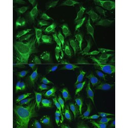 Mimecan (OGN) Antibody