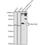 abx006391
