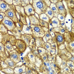 Asialoglycoprotein Receptor 1 (ASGR1) Antibody