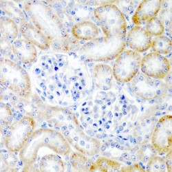 Prorelaxin H2 (RLN2) Antibody