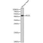 Western blot analysis of lysates from Mouse heart, using RGS5 Antibody at 1/1000 dilution. Secondary antibody: HRP-conjugated Goat anti-Rabbit IgG (H+L) at 1/10000 dilution. Lysates/proteins: 25 µg per lane. Blocking buffer: 3% nonfat dry milk in TBST. Exposure time: 90s.