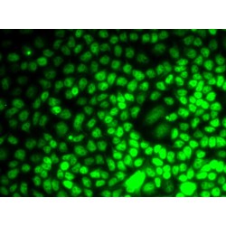 Cyclin E2 (CCNE2) Antibody
