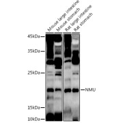 Western blot analysis of various lysates using NMU Antibody at 1/1000 dilution. Secondary antibody: HRP-conjugated Goat anti-Rabbit IgG (H+L) at 1/10000 dilution. Lysates/proteins: 25 µg per lane. Blocking buffer: 3% nonfat dry milk in TBST. Exposure time: 180s.