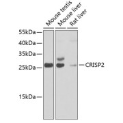 Western blot analysis of various lysates using CRISP2 Antibody at 1/1000 dilution. Secondary antibody: HRP-conjugated Goat anti-Rabbit IgG (H+L) at 1/10000 dilution. Lysates/proteins: 25 µg per lane. Blocking buffer: 3% nonfat dry milk in TBST. Exposure time: 5s.