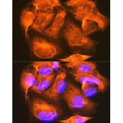 Phosphorylase Kinase Catalytic Subunit Gamma 2 (PHKG2) Antibody