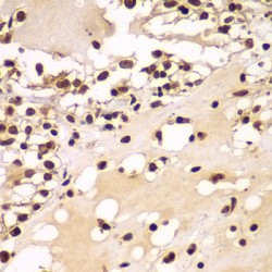 Zinc Finger Protein 20 (ZNF20) Antibody