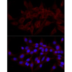 Calcium-Binding And Coiled-Coil Domain-Containing Protein 2 (CALCOCO2) Antibody