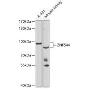 Western blot analysis of various lysates using ZNF544 Antibody at 1/1000 dilution. Secondary antibody: HRP-conjugated Goat anti-Rabbit IgG (H+L) at 1/10000 dilution. Lysates/proteins: 25 µg per lane. Blocking buffer: 3% nonfat dry milk in TBST. Exposure time: 90s.