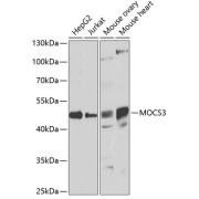 Western blot analysis of various lysates using MOCS3 Antibody at 1/1000 dilution. Secondary antibody: HRP-conjugated Goat anti-Rabbit IgG (H+L) at 1/10000 dilution. Lysates/proteins: 25 µg per lane. Blocking buffer: 3% nonfat dry milk in TBST. Exposure time: 90s.