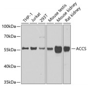 Western blot analysis of various lysates using ACCS Antibody at 1/1000 dilution. Secondary antibody: HRP-conjugated Goat anti-Rabbit IgG (H+L) at 1/10000 dilution. Lysates/proteins: 25 µg per lane. Blocking buffer: 3% nonfat dry milk in TBST. Exposure time: 90s.