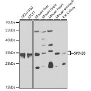 Western blot analysis of various lysates using SPIN2B Antibody at 1/1000 dilution. Secondary antibody: HRP-conjugated Goat anti-Rabbit IgG (H+L) at 1/10000 dilution. Lysates/proteins: 25 µg per lane. Blocking buffer: 3% nonfat dry milk in TBST. Exposure time: 90s.