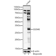 Western blot analysis of various lysates using GSDME Antibody at 1/1000 dilution incubated overnight at 4 °C. Secondary antibody: HRP-conjugated Goat anti-Rabbit IgG (H+L) at 1/10000 dilution. Lysates/proteins: 25 µg per lane. Blocking buffer: 3% nonfat dry milk in TBST. Exposure time: 90s.