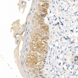 Keratin 16 (KRT16) Antibody