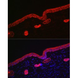 Keratin 16 (KRT16) Antibody