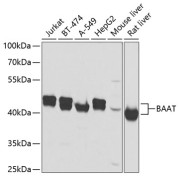 Western blot analysis of various lysates using BAAT Antibody at 1/2000 dilution. Secondary antibody: HRP-conjugated Goat anti-Rabbit IgG (H+L) at 1/10000 dilution. Lysates/proteins: 25 µg per lane. Blocking buffer: 3% nonfat dry milk in TBST. Exposure time: 1s.