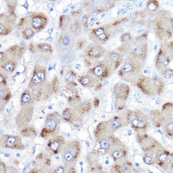 Bile Acid-CoA:amino Acid N-Acyltransferase (BAAT) Antibody