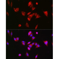 Bile Acid-CoA:amino Acid N-Acyltransferase (BAAT) Antibody
