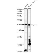 Western blot analysis of various lysates, using SYT4 Antibody at 1/1000 dilution. Secondary antibody: HRP-conjugated Goat anti-Rabbit IgG (H+L) at 1/10000 dilution. Lysates/proteins: 25 µg per lane. Blocking buffer: 3% nonfat dry milk in TBST. Exposure time: 180s.