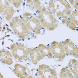Synaptotagmin 4 (SYT4) Antibody