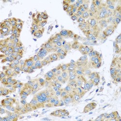 Synaptotagmin 4 (SYT4) Antibody