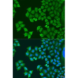 Synaptotagmin 4 (SYT4) Antibody