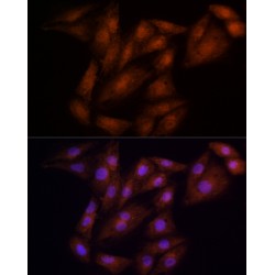 ECSIT Homolog (Drosophila) (ECSIT) Antibody
