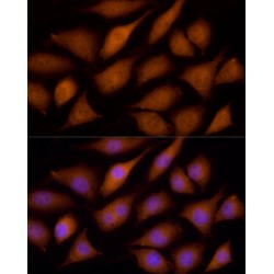 ECSIT Homolog (Drosophila) (ECSIT) Antibody