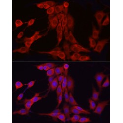 Inositol Polyphosphate 5-Phosphatase K (INPP5K) Antibody