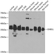 Western blot analysis of various lysates using GNB1L Antibody at 1/1000 dilution. Secondary antibody: HRP-conjugated Goat anti-Rabbit IgG (H+L) at 1/10000 dilution. Lysates/proteins: 25 µg per lane. Blocking buffer: 3% nonfat dry milk in TBST. Exposure time: 90s.