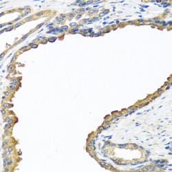 Nyctalopin (NYX) Antibody