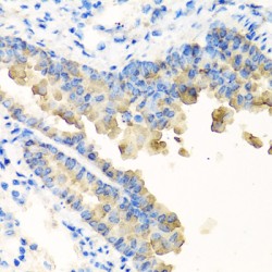 Nyctalopin (NYX) Antibody