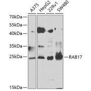 Western blot analysis of various lysates using RAB17 Antibody at 1/1000 dilution. Secondary antibody: HRP-conjugated Goat anti-Rabbit IgG (H+L) at 1/10000 dilution. Lysates/proteins: 25 µg per lane. Blocking buffer: 3% nonfat dry milk in TBST. Exposure time: 90s.