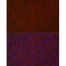 Leucine-Rich Alpha-2-Glycoprotein (LRG1) Antibody