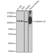 Western blot analysis of various lysates using Cadherin 16 Antibody at 1/1000 dilution. Secondary antibody: HRP-conjugated Goat anti-Rabbit IgG (H+L) at 1/10000 dilution. Lysates/proteins: 25 µg per lane. Blocking buffer: 3% nonfat dry milk in TBST. Exposure time: 90s.