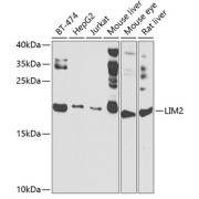 Western blot analysis of various lysates using LIM2 Antibody at 1/1000 dilution. Secondary antibody: HRP-conjugated Goat anti-Rabbit IgG (H+L) at 1/10000 dilution. Lysates/proteins: 25 µg per lane. Blocking buffer: 3% nonfat dry milk in TBST. Exposure time: 90s.