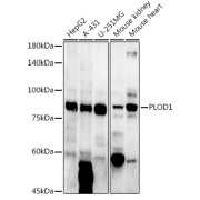 Western blot analysis of various lysates using PLOD1 Antibody at 1/1000 dilution. Secondary antibody: HRP-conjugated Goat anti-Rabbit IgG (H+L) at 1/10000 dilution. Lysates/proteins: 25 µg per lane. Blocking buffer: 3% nonfat dry milk in TBST. Exposure time: 180s.