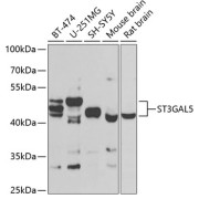 Western blot analysis of various lysates using ST3GAL5 Antibody at 1/1000 dilution. Secondary antibody: HRP-conjugated Goat anti-Rabbit IgG (H+L) at 1/10000 dilution. Lysates/proteins: 25 µg per lane. Blocking buffer: 3% nonfat dry milk in TBST. Exposure time: 90s.