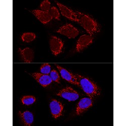 Metaxin 2 (MTX2) Antibody