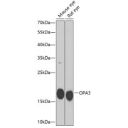 Western blot analysis of various lysates using OPA3 Antibody at 1/1000 dilution. Secondary antibody: HRP-conjugated Goat anti-Rabbit IgG (H+L) at 1/10000 dilution. Lysates/proteins: 25 µg per lane. Blocking buffer: 3% nonfat dry milk in TBST. Exposure time: 90s.