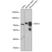 Western blot analysis of various lysates using EFHC1 Antibody at 1/1000 dilution. Secondary antibody: HRP-conjugated Goat anti-Rabbit IgG (H+L) at 1/10000 dilution. Lysates/proteins: 25 µg per lane. Blocking buffer: 3% nonfat dry milk in TBST. Exposure time: 90s.