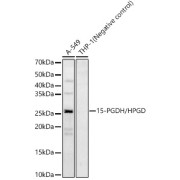 Western blot analysis of various lysates, using 15-PGDH/HPGD Antibody at 1/2000 dilution. Secondary antibody: HRP-conjugated Goat anti-Rabbit IgG (H+L) at 1/10000 dilution. Lysates/proteins: 25 µg per lane. Blocking buffer: 3% nonfat dry milk in TBST. Exposure time: 180s.