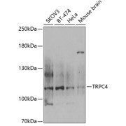 Western blot analysis of various lysates using TRPC4 Antibody at 1/1000 dilution. Secondary antibody: HRP-conjugated Goat anti-Rabbit IgG (H+L) at 1/10000 dilution. Lysates/proteins: 25 µg per lane. Blocking buffer: 3% nonfat dry milk in TBST. Exposure time: 90s.