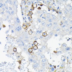 Leukocyte Immunoglobulin Like Receptor Subfamily B Member 4 (LILRB4) Antibody