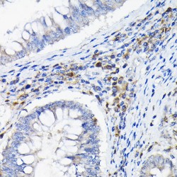 Leukocyte Immunoglobulin Like Receptor Subfamily B Member 4 (LILRB4) Antibody