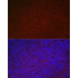 Leukocyte Immunoglobulin Like Receptor Subfamily B Member 4 (LILRB4) Antibody