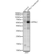 Western blot analysis of lysates from wild type (WT) and 293T cells transfected with BTNL2 using BTNL2 Antibody at 1/3000 dilution. Secondary antibody: HRP-conjugated Goat anti-Rabbit IgG (H+L) at 1/10000 dilution. Lysates/proteins: 25 µg per lane. Blocking buffer: 3% nonfat dry milk in TBST. Exposure time: 60s.